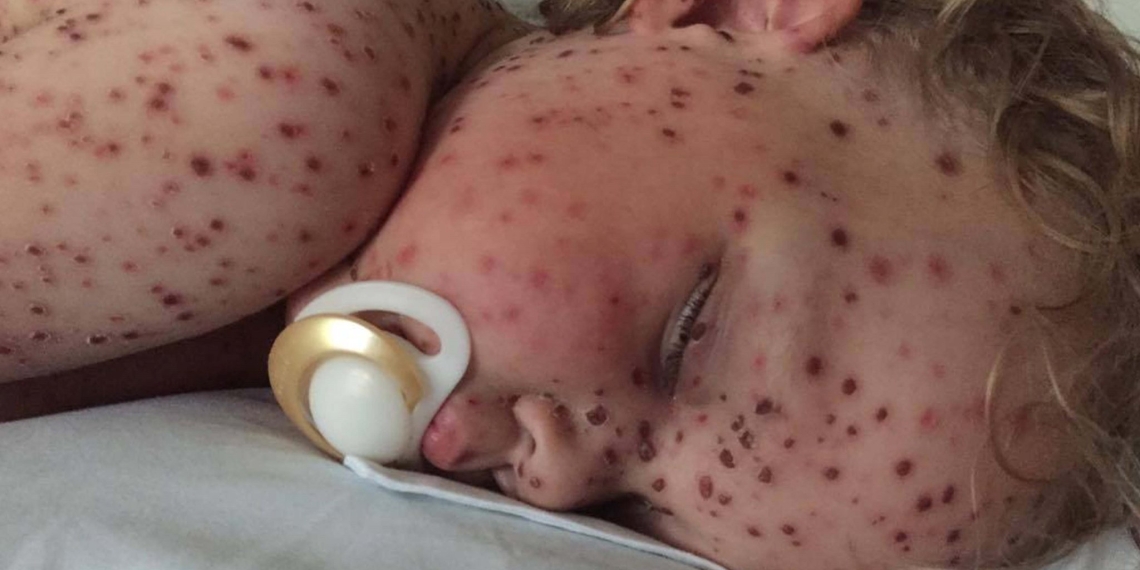 Facebook investigates fake cancer child post