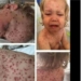 Facebook deletes fake child-cancer posts accounts