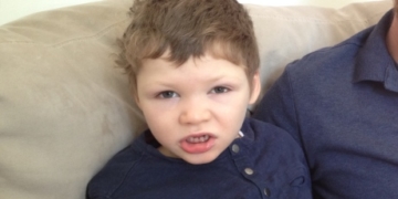 Cannabidiol reduces seizures in kids with severe form of epilepsy, trial shows