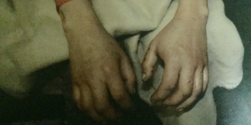 Refusal to pick up hotel bill by Crown and police led to sex assault victim being jailed