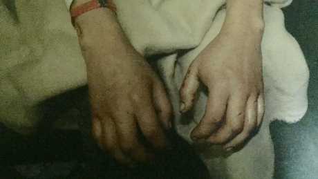 Refusal to pick up hotel bill by Crown and police led to sex assault victim being jailed