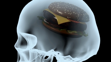 Investigating obesity: It’s not just about eating too much