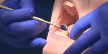 B.C. government boosts health coverage for low-income kids