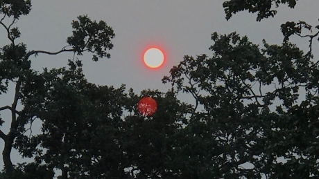 Vancouver Island Health Authority expects spike in childhood asthma hospitalizations