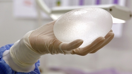 Health Canada finds low number of rare cancer cases linked to breast implants
