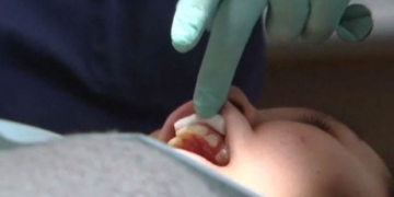 Health Canada doesn’t know if its dental programs benefiting Indigenous Canadians: report