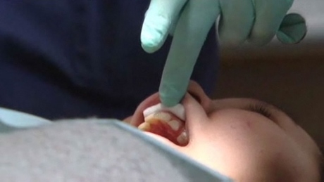 Health Canada doesn’t know if its dental programs benefiting Indigenous Canadians: report