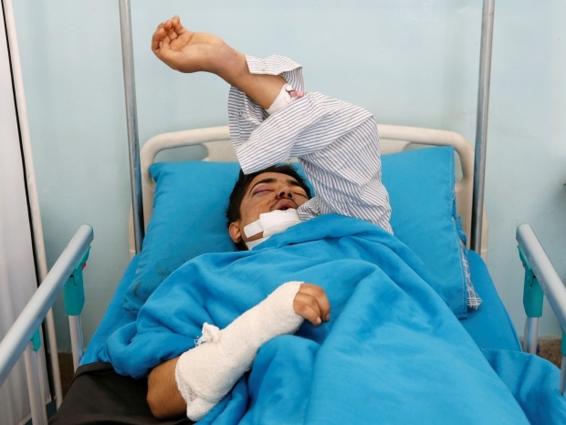 Kabul hotel attack survivors grateful to be alive