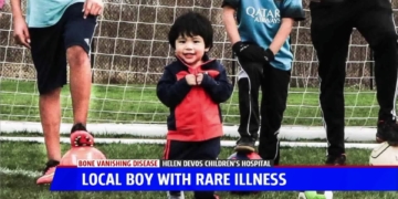 2-year-old diagnosed with rare 'Vanishing Bone' disease