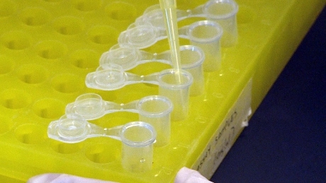 DNA test to spot cancer genes gets OK from U.S. regulator, but with warnings