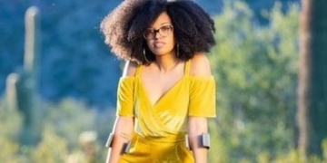 Hot, disabled and not afraid to show it