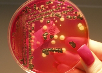 Canada’s Public Health Agency says Salmonella Outbreak Hits 6 Provinces, Dozens sick and Two Dead