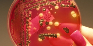 Canada’s Public Health Agency says Salmonella Outbreak Hits 6 Provinces, Dozens sick and Two Dead