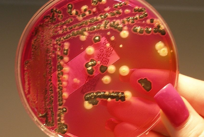 Canada’s Public Health Agency says Salmonella Outbreak Hits 6 Provinces, Dozens sick and Two Dead