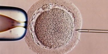 ‘Three-person’ baby boy born in Greece