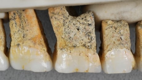Bones found in Philippines may belong to previously unknown human relative