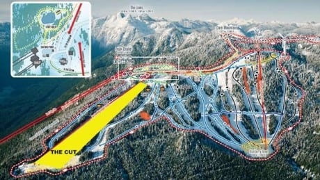 Teen suffers head injury following incident on Grouse Mountain