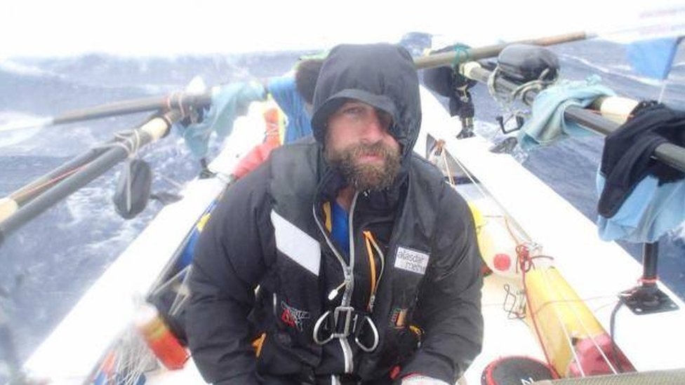 UK man donates frostbitten toe to Yukon bar