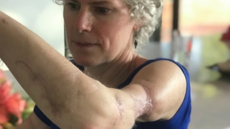 ‘They tore my muscles as if I was their prey’: Dog attack survivor wants negligent owners held responsible
