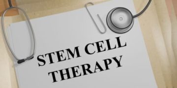 Health Canada requests Sudbury clinic stop selling stem cell therapies