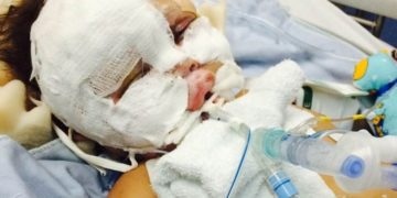 $12.3M payout for infant burned in Madigan operating-room fire delayed as feds consider appeal