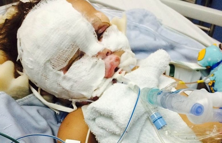 $12.3M payout for infant burned in Madigan operating-room fire delayed as feds consider appeal
