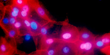 Guidelines say more women may need breast cancer gene test