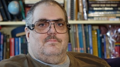 Kingston man waits years for surgery to relieve painful condition