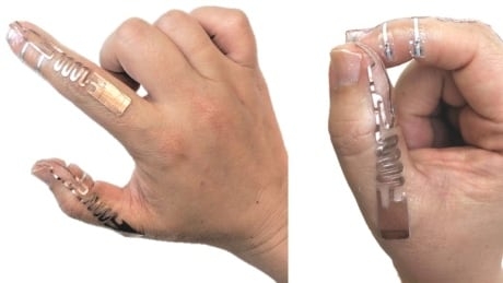 Introducing ‘Tip-Tap’ Waterloo’s new sci-fi tech for surgeons