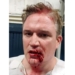 &lsquo;So… my face is a brick magnet’: NYPD lieutenant sports bloody face after violent clashes with George Floyd protesters