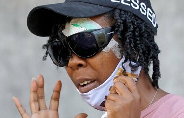 Seattle police crowd-control tactics come under fire by people injured in protests