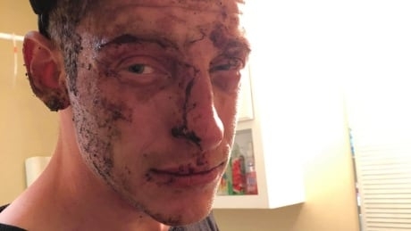 Kelowna man punched in head during arrest sues RCMP officer