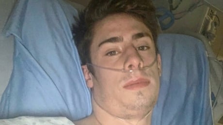 ‘A bit unnerving’: COVID-19 survivors worried about future consequences