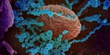 Wait for ‘herd immunity’ would cost lives, imperil health-care system, Alberta’s top doctor says