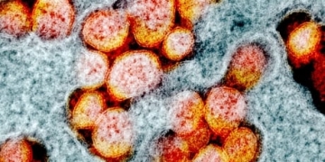 What you need to know about COVID-19 in Alberta on Tuesday, Oct. 27