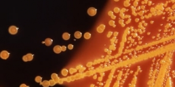 Bacteria-hunting viruses can track down antibiotic-resistant bugs where they hide