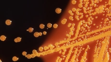 Bacteria-hunting viruses can track down antibiotic-resistant bugs where they hide