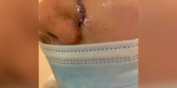 Manhattan prosecutors pursuing hate crime charges against man accused of assaulting Asian American woman with a pipe