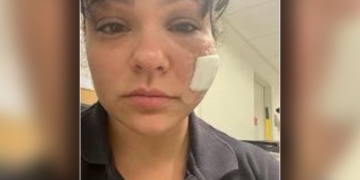 FDNY paramedic bit in the face while treating unstable patient in Brooklyn: officials