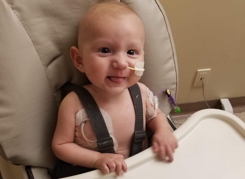 Toronto surgeons give Winnipeg baby another shot at life after removing nearly 3-pound tumour