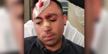 ‘I was gushing blood everywhere’: EMT bashed by patient in Brooklyn hospital, leaving him with broken nose, stitches